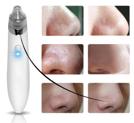 Blackhead Remover Machine